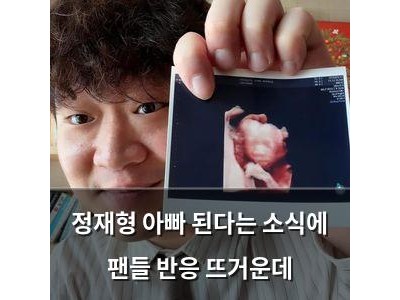 정재형 아빠 된다는 소식에 팬들 반응 뜨거운데