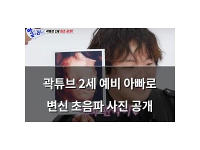 곽튜브 2세 예비 아빠로 변신 초음파 사진 공개